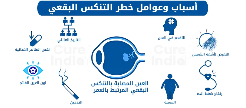 أسباب وعوامل خطر التنكس البقعي